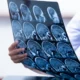 radiograph of acquired brain injury