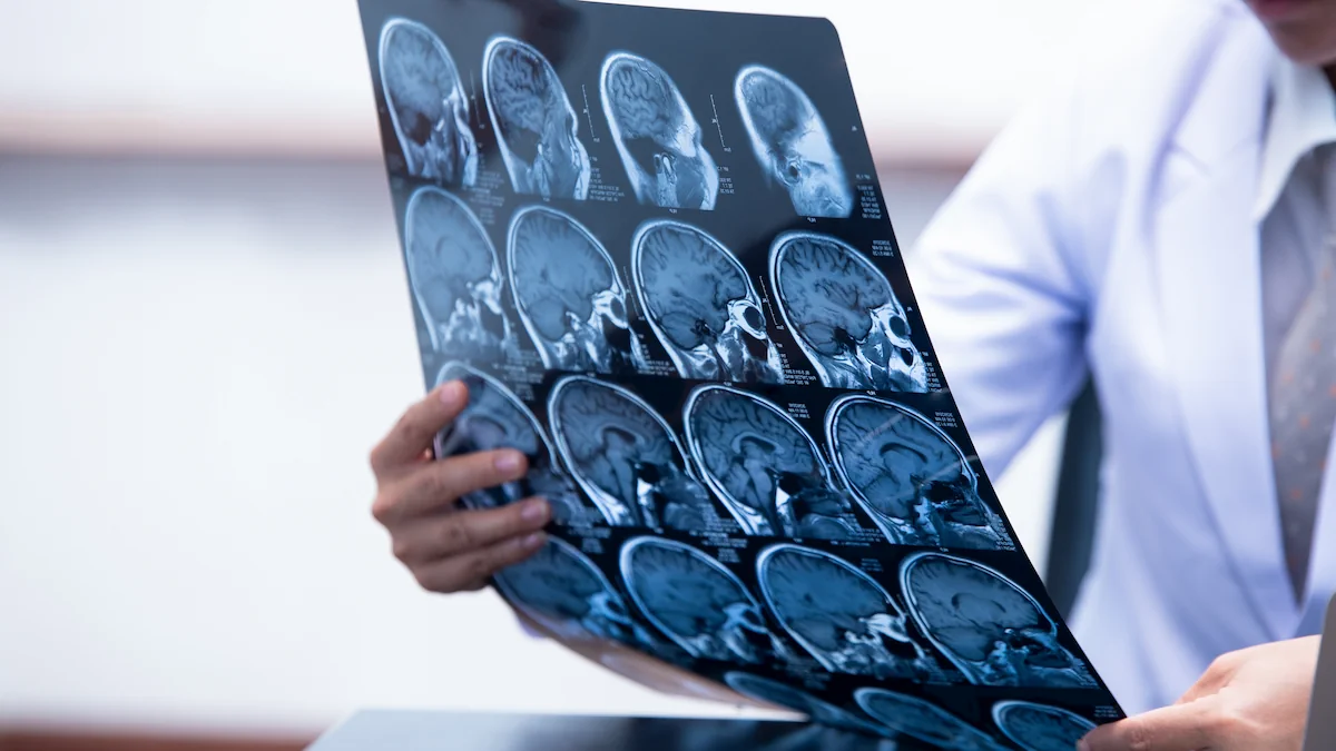 radiograph of acquired brain injury
