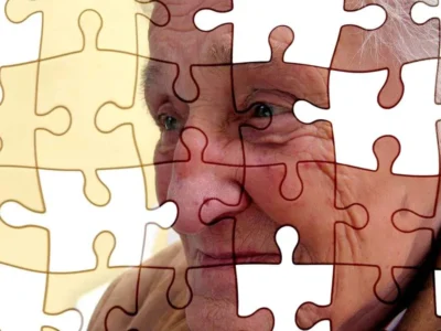 Visual perception in Alzheimer's disease