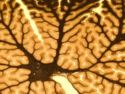 Motor learning: what it is, factors, methodology, and objective