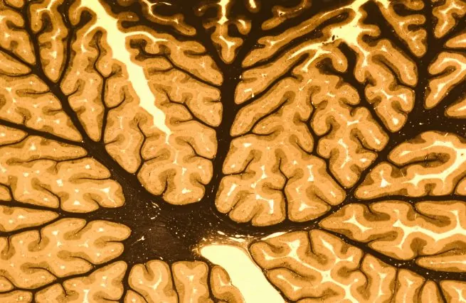 Motor learning: what it is, factors, methodology, and objective