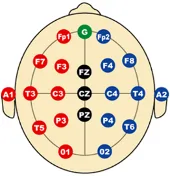 The Clinical Q determines the design of treatment with neurofeedback.