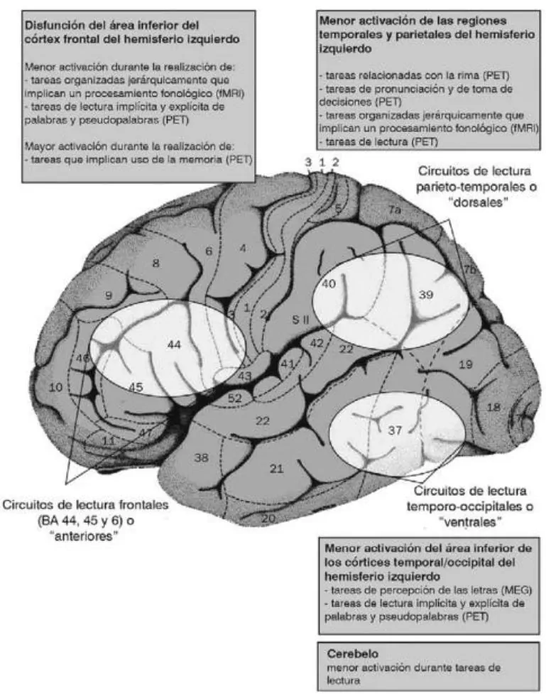 executive functions. Reading circuits and dysfunction in the reading process.