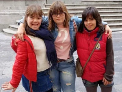 Cognitive intervention in people with Down syndrome
