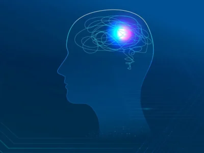 Aphasia: differential diagnosis