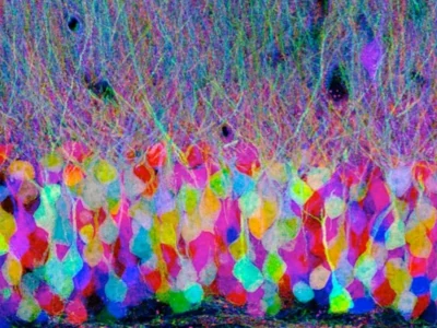 Brainbow: How to color a brain. Colored neurons.