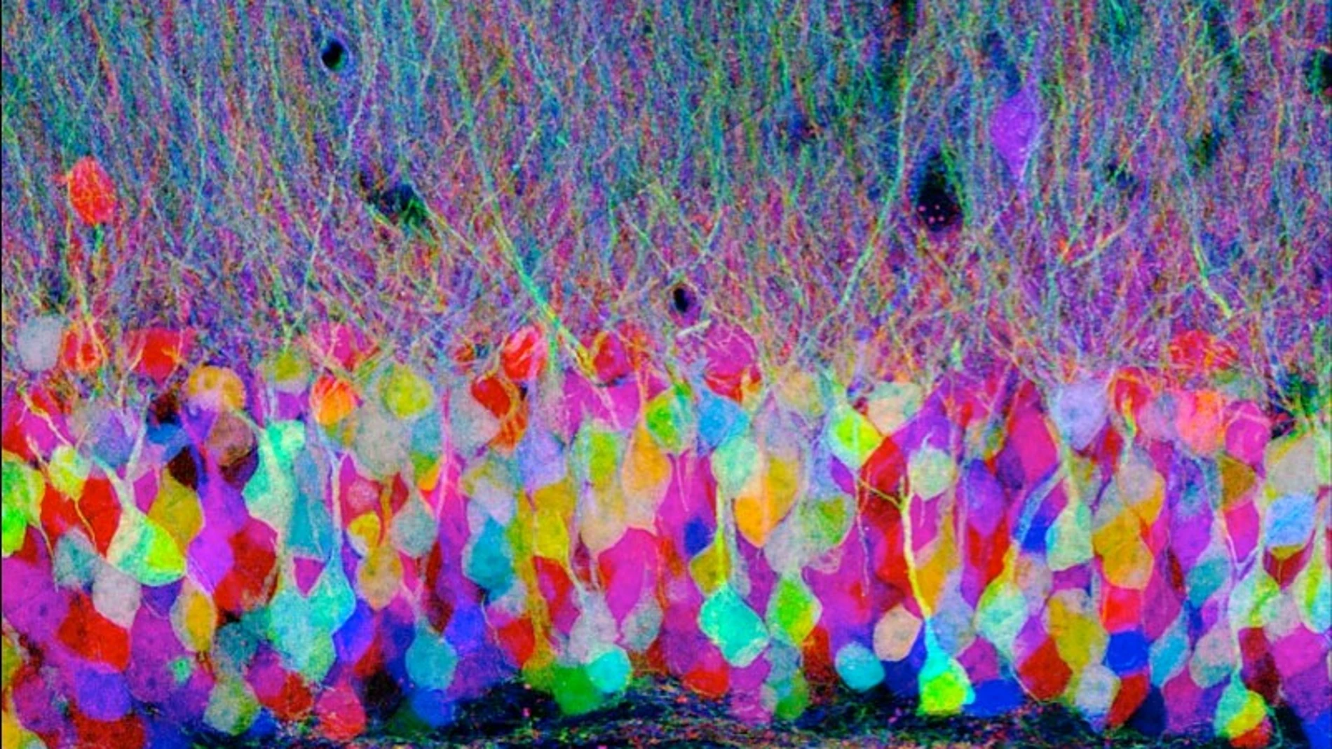 Brainbow: How to color a brain. Colored neurons.