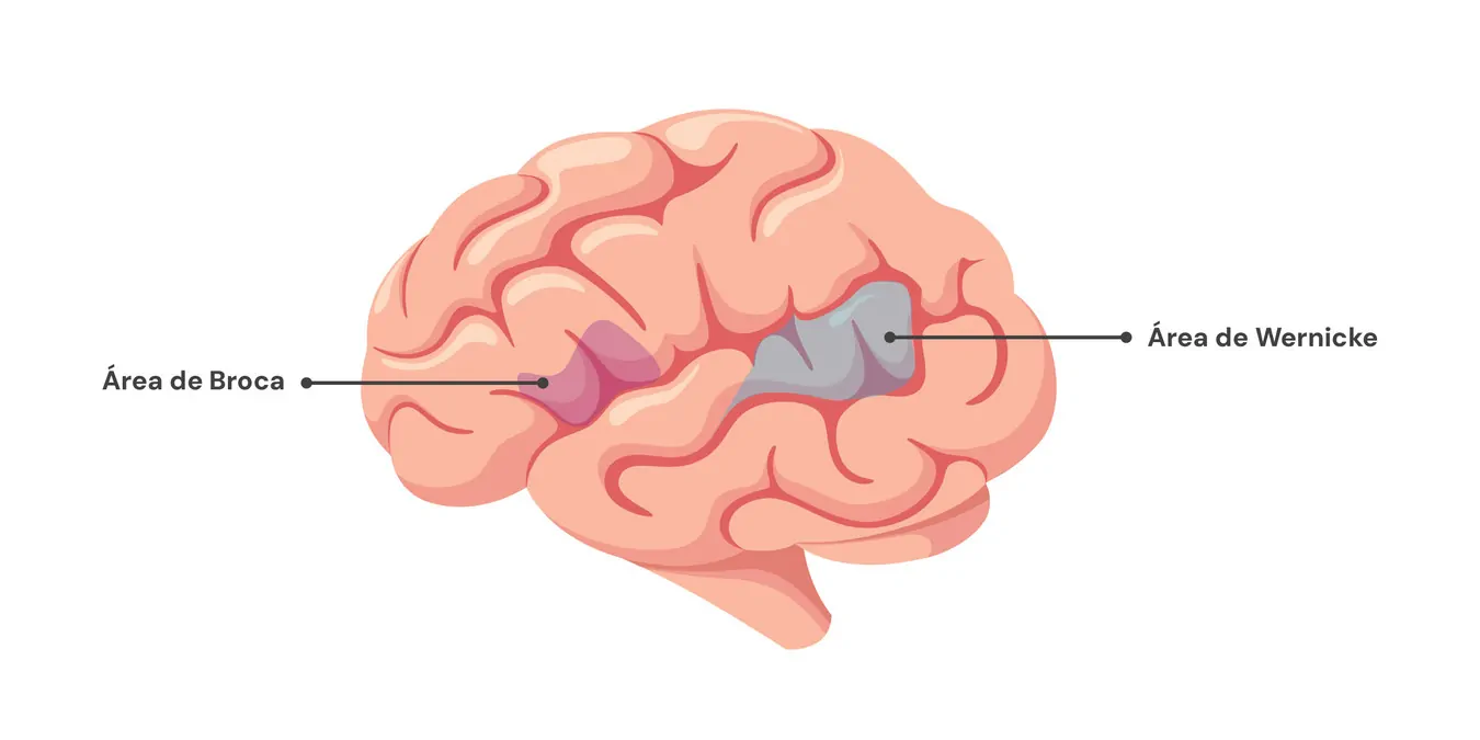 Broca's and Wernicke's areas