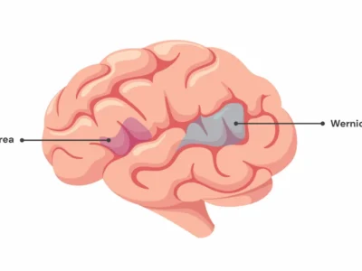 Broca’s and Wernicke’s Areas