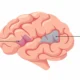Broca’s and Wernicke’s Areas
