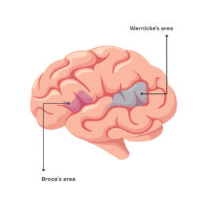 Broca's and Wernicke's areas in the brain.