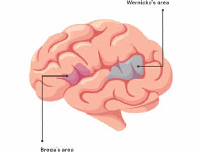 Broca's and Wernicke's areas in the brain.