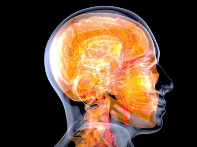 Dementia with Lewy bodies NeuronUP