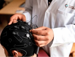 Electrode montage prior to the application of tDCS stimulation