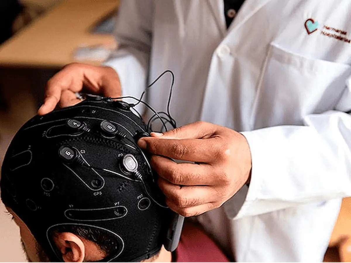Electrode montage prior to the application of tDCS stimulation