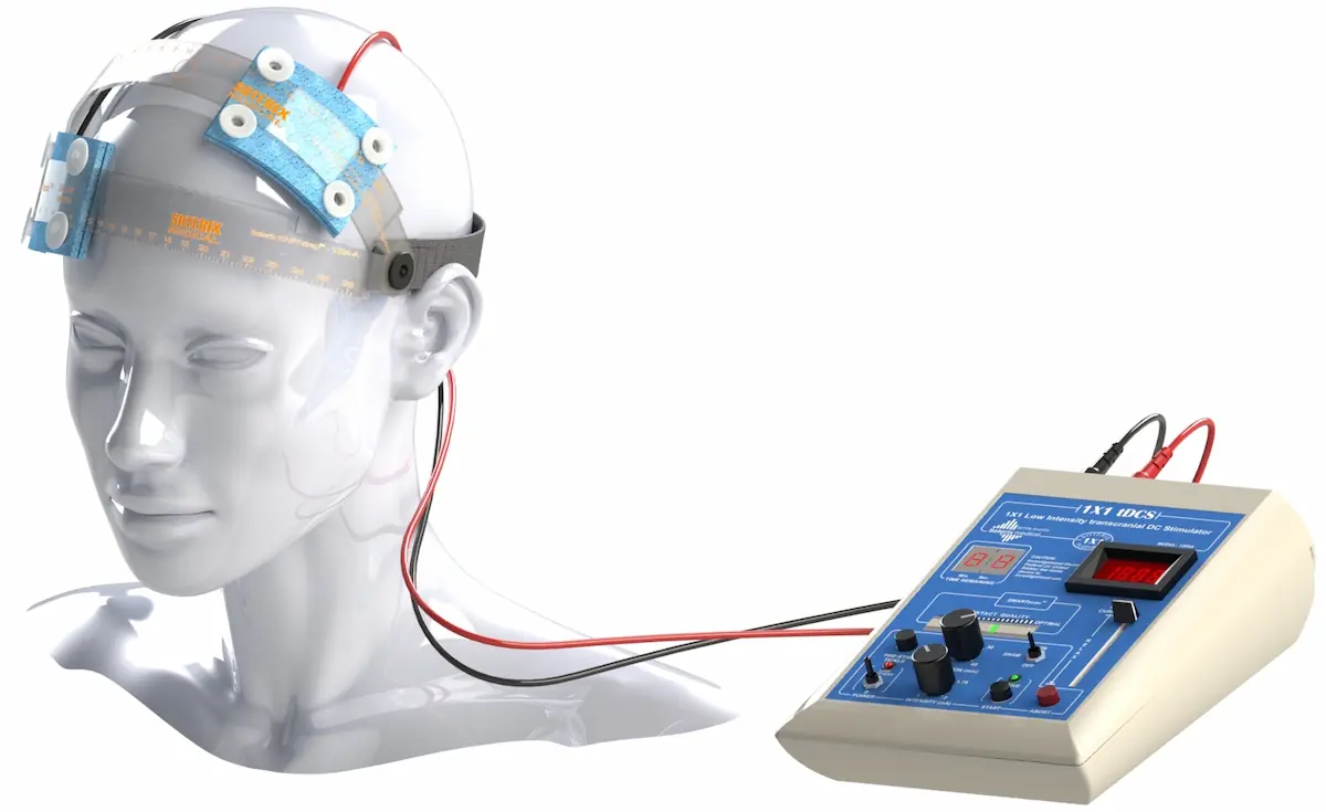 Applications of Neuromodulation in Neurorehabilitation