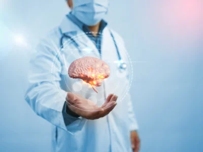 Placebo Effect in Cognitive Stimulation: What It Is, Scientific Evidence, and Clinical Keys for Applying It in Neurorehabilitation