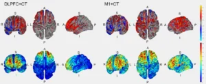 Feasibility study of neuromodulation and cognitive training for post-COVID fatigue