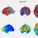 Feasibility study of neuromodulation and cognitive training for post-COVID fatigue