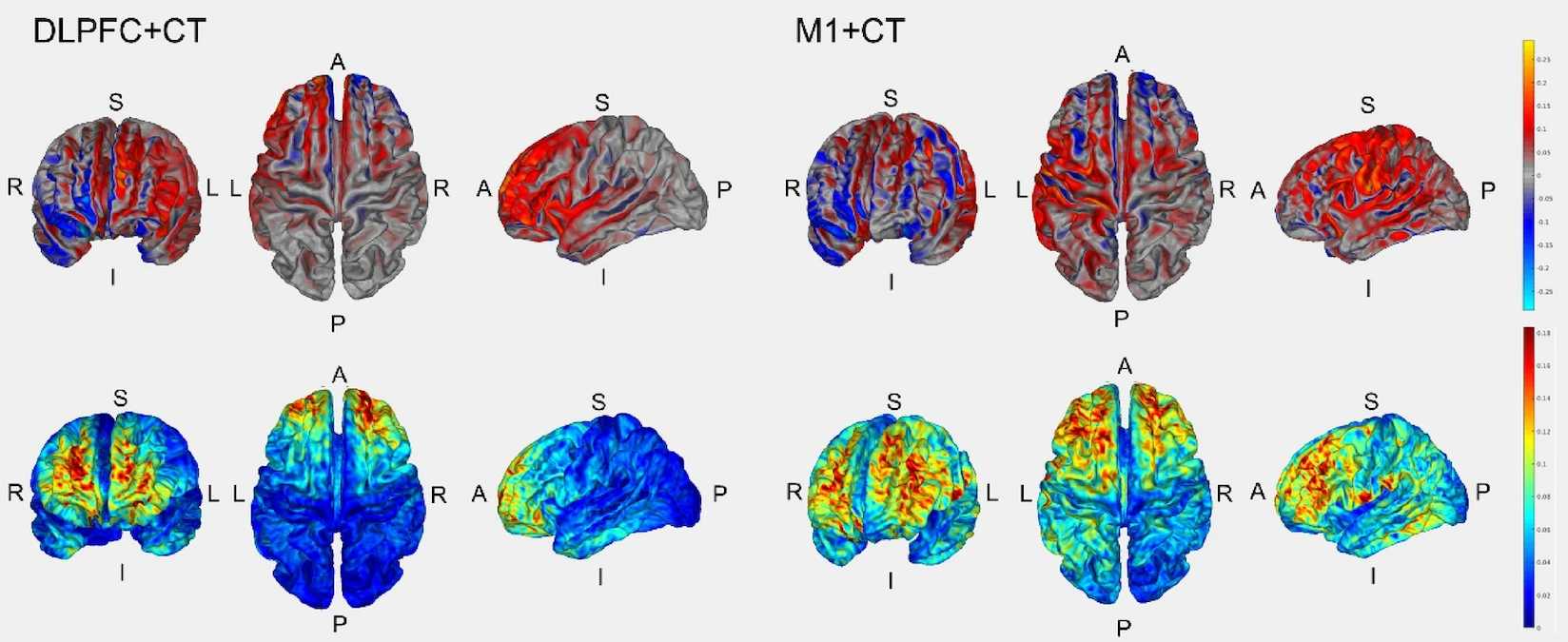 Feasibility study of neuromodulation and cognitive training for post COVID útigue