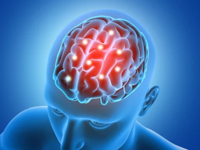 3D representation of a human brain in red and blue, with illuminated areas and assessment icons connected to TBI and diaschisis.