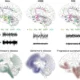 Neural networks involved in sleep-wake cycle regulation and the distribution of pathology in different neurodegenerative diseases.